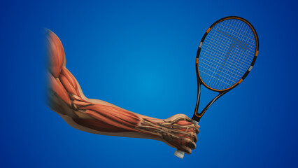 Wall Mural - Tennis elbow Area of pain inflammation