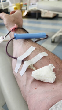 a man's hand with a needle inserted into it and tubes for blood transfusion. blood donation