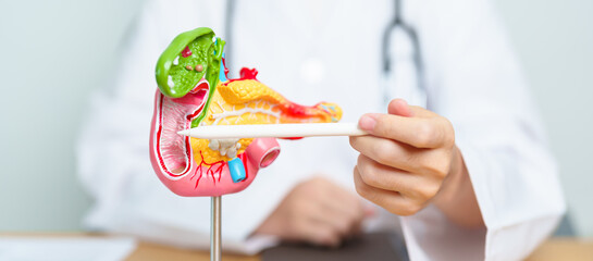 Doctor with human Pancreatitis anatomy model with Pancreas, Gallbladder, Bile Duct, Duodenum, Small intestine and tablet. Pancreatic cancer, acute pancreatitis and Digestive system