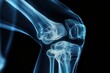 © sornthanashatr - A knee joint is shown in a black and white photo with a blue hue