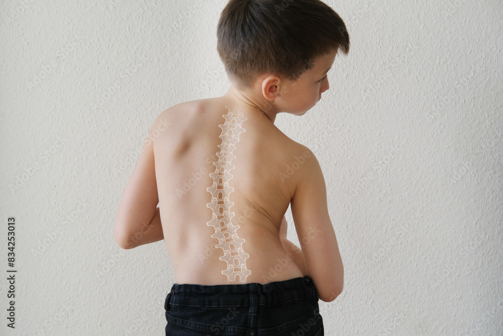 naked back of boy, child 8-10 years old grabbed a sore spot, curved ...