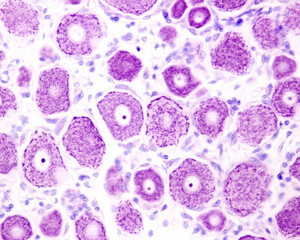 Poster - Dorsal root ganglion neurons. Nissl bodies