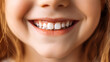 © Anthichada - Close up of a smiling little girl with white teeth, Close up view of a children girl mouth with healthy teeth