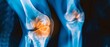 © Thanakrit - Highquality closeup xray imaging of knee joint pain in man, diagnostic illustration