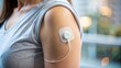 © Wanlop - Close-up of a continuous glucose monitor device being attached to an arm, with adhesive strips and sensor visible, on a blurred background.