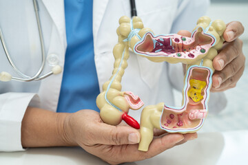 Wall Mural - Intestine, appendix and digestive system, doctor holding anatomy model for study diagnosis and treatment in hospital.