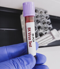 Poster - Blood sample for Real time PCR BK virus test.