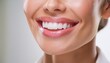 © Marko - Dental care, beautiful smile of healthy woman, white teeth coloseup