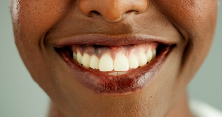 Poster - Person, african and closeup with teeth, smile and dental care and oral hygiene or health. Mouth, zoom and portrait with wellness, medical and happy with dentist results and whitening for beauty