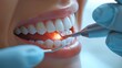 © Sarinya - Futuristic Dental Hygienist Utilizing Ultrasonic Scaler in Modern Clinic - Innovation in Advanced Dental Technology