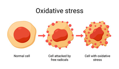 Oxidative stress vector design illustration