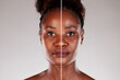 © Andrey Popov - The Transformation of a Young African American Woman's Skin: Before