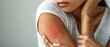 © Nuth - Close up of a woman with irritated red skin on her arm, suggesting an allergic reaction or skin condition. She is holding her arm with one hand.