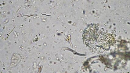 Wall Mural - soil microorganisms under a microscope including amoeba, flagellates, nematodes, fungi, bacteria, from a soil sample on a regenerative agriculture farm in Australia