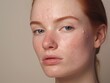 © vefimov - Close-up portrait of a woman with freckles, suitable for beauty or lifestyle editorial use