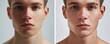 © Dalibor - Close-up comparison of male jawline, before and after cosmetic surgery, highlighting transformation and enhancement.
