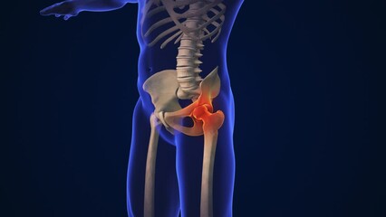 Wall Mural - Anatomy Human Hip Joint Treatment