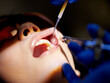 © peopleimages.com - Person, mouth and tools with woman at dentist for oral hygiene or dental care appointment closeup. Hands, healthcare and medical equipment with patient in chair at clinic for operation or surgery
