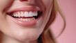 © AndreyFrol - Close-up of a woman's smile with perfect white teeth. The pink lips are slightly parted, revealing smooth and shiny teeth. A delicate pink background that gives the image a softness