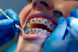 © BetterPhoto - Close-up of a dental examination with braces on teeth. The dentist's gloved hands and tools are visible, highlighting the orthodontic care