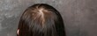 © Sonu - A woman shows the back of her head