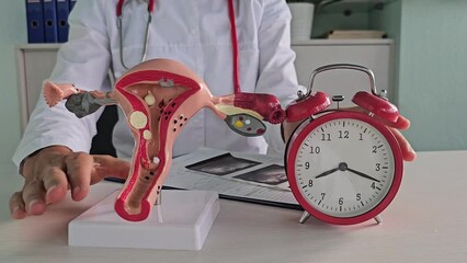 Poster - Model of the uterus and alarm clock in hands of gynecologist