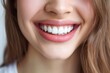 © Alona - Healthy Teeth Smile of Young Woman. Dental Care and Teeth Whitening Concept