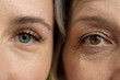 © Grustock - A close-up comparison of the eyes of a young woman and an older woman, highlighting the visible differences in skin texture and wrinkles