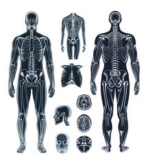 human body x-ray cartoon vector set. head torso back brain skeleton bones skull medical examination 