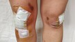 © Rung Kh - portrait showing the accident and have a wounds injured on the body, Bandage on the knee, Bruises on the body, health care and medical concept.