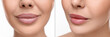 © New Africa - Permanent makeup. Collage with photos of woman before and after lip blushing on white background, closeup