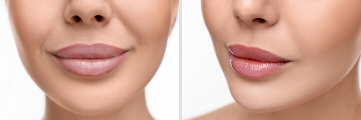 Poster - Permanent makeup. Collage with photos of woman before and after lip blushing on white background, closeup