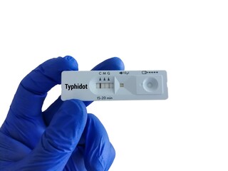 Canvas Print - Rapid screening test for Typhidot test, to diagnose typhoid fever