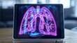 © Otseira - transparent tablet display showing respiratory syndrome (lung)