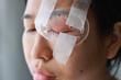 © TripleP Studio - Asian woman's covered eye with plastic clear shields protective irritation and wounds to cornea, causing eye to become swollen and red. eye become inflamed. Ophthalmologist treats eye infections.