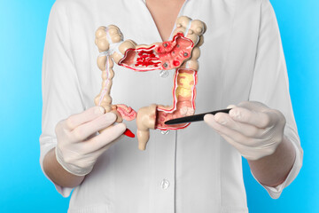 Canvas Print - Doctor showing model of large intestine on light blue background, closeup