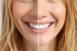 © Anat art - Close-up image of a womans smile, showing a comparison of her teeth before and after a whitening treatment. Generative AI