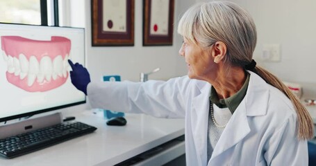 Wall Mural - Woman, dentist and computer screen with mouth for dental demonstration, inspection and explain treatment plan. Orthodontist, pc and study tooth shape, implant and veneer learning for development