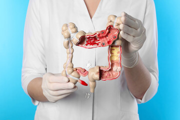 Wall Mural - Doctor with model of large intestine on light blue background, closeup