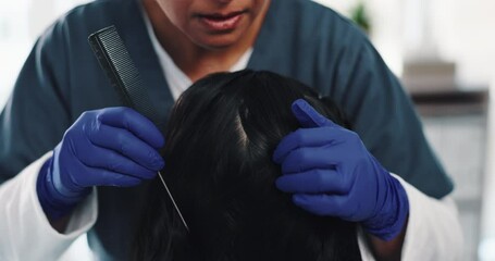 Poster - Comb, examine and doctor with hair for inspection, gloves and haircare for patient and consultation in clinic. Texture, damage and burning of scalp, lice and diagnosis of infection by trichologist