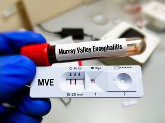 Canvas Print - Blood sample and rapid test cassette for Murray Valley encephalitis (MVE) virus test