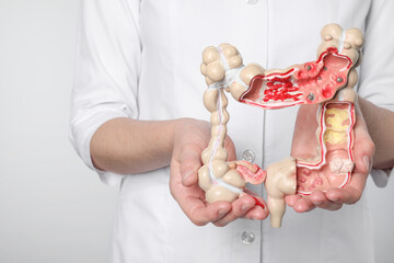 Wall Mural - Doctor with model of large intestine on light grey background, closeup