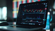 © Mahemud - Laptops showing real-time stock market statistics and data on their screens.