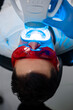 © Rabizo Anatolii - Patient whitens his teeth wearing goggles and lip retractor. Dental whitening procedure by ultraviolet light.