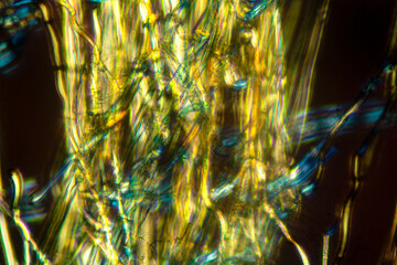 Poster - Glowing fibers of the hairy calyptra of polytrichum moss.