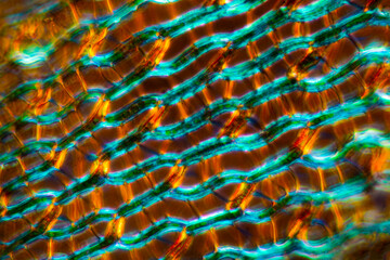 Poster - Branch leaf of Sphagnum squarrosum, with polarization at 400x.