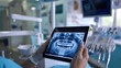© redflower - Doctor Showing Dental X-ray on Tablet in Dental Clinic