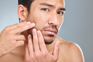 Poster - Hands, skincare and pimple with man in studio, facial and wellness on white background. Dermatology, fingers or beauty for cosmetic acne for male person, dehydrated or selfcare for grooming treatment