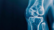 © Rona_65 - Detailed X-ray image of a human knee joint showcasing bones and cartilage, perfect for medical and educational purposes.