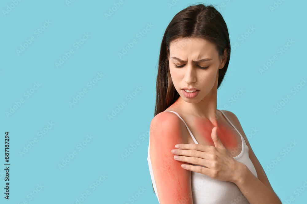 Allergic young woman with red sunburned skin on blue background